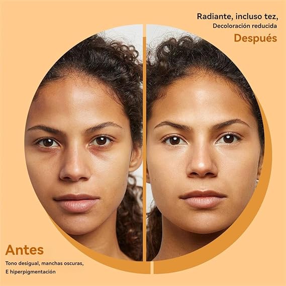 TURMERIC X2 | Jabón de Cúrcuma Reduce el Acné, Atenúa las Manchas y Aclara Zonas Oscuras de todo tu Cuerpo