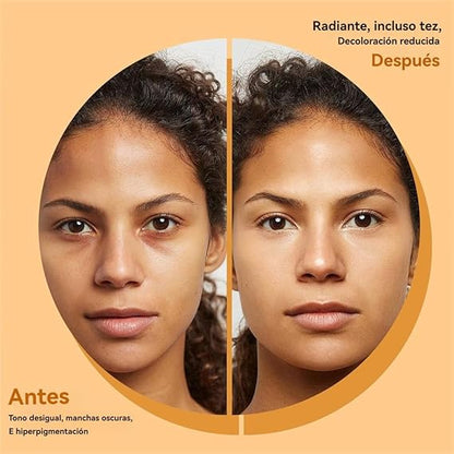 TURMERIC X2 | Jabón de Cúrcuma Reduce el Acné, Atenúa las Manchas y Aclara Zonas Oscuras de todo tu Cuerpo