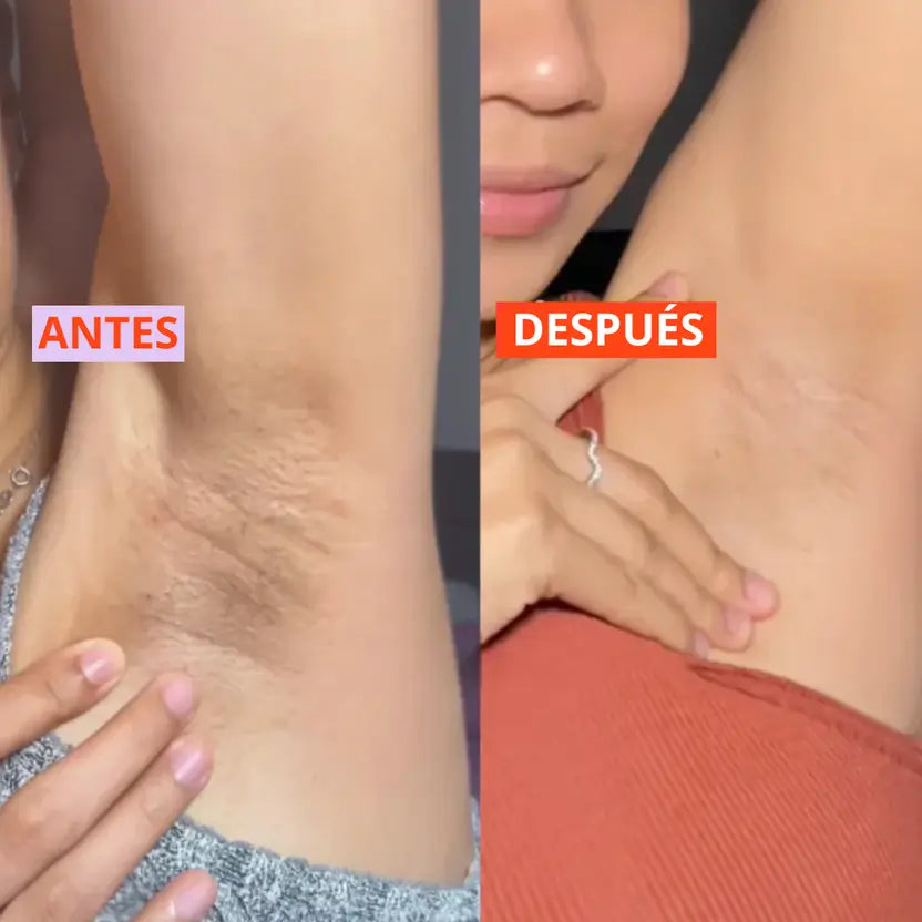 Dr. Melaxim Peel Shot | Exfoliante Coreano con Arroz y Niacinamida Despigmenta Tu Piel en 30 días🎁OBSEQUIO GRATIS